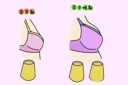 怀孕期间乳房胀痛、不适。该如何做好乳房护理