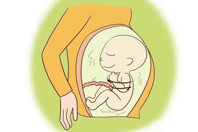 孕期摸肚子不当会导致脐带绕颈吗？准妈妈可要多注意了