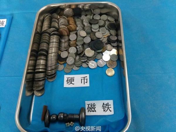 被熊孩子吞过的异物
