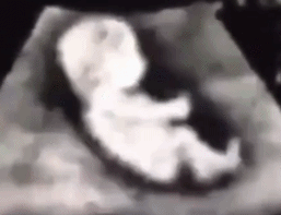 胎宝宝每天在妈妈肚子竟有这么多事情做！太好玩，快看