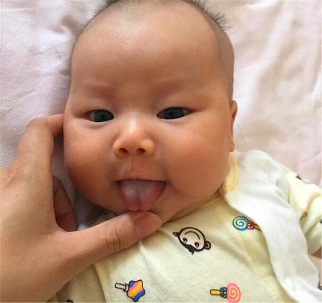 2、3岁的孩子，说话含糊不清，有可能是“舌系带短”