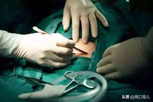 剖腹产刀口护理，产后做好这几件事情，让伤疤恢复到最好状态