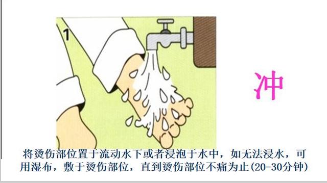 记住这五个步骤，孩子在家发生烫伤时，可以最大化的避免损伤