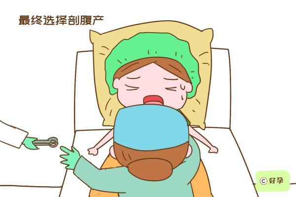 为何那么多产妇宁愿肚子“挨刀”，也不想侧切？医生说出实情