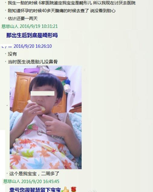孕期四维大排畸，胎儿鼻骨缺如，还有希望别放弃，给胎儿一个机会