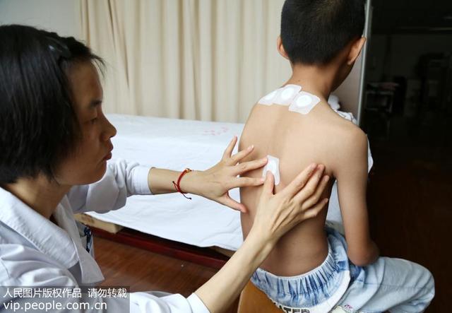 孩子咳嗽老不好 警惕咳嗽变异性哮喘