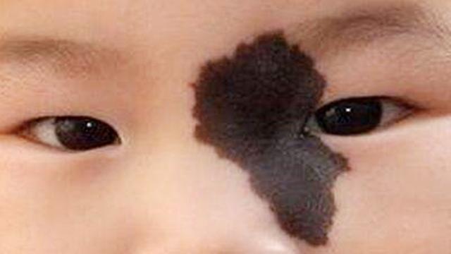 孕期这4件事会影响宝宝&quot;颜值&quot;,不想宝宝长胎记变丑，孕妈最好别做