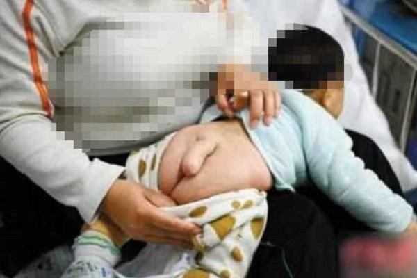7个月男婴，长出尾巴，儿科医生道出真相，妈妈掩面哭泣