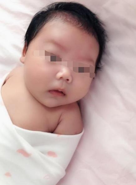 孕期四维大排畸，胎儿鼻骨缺如，还有希望别放弃，给胎儿一个机会