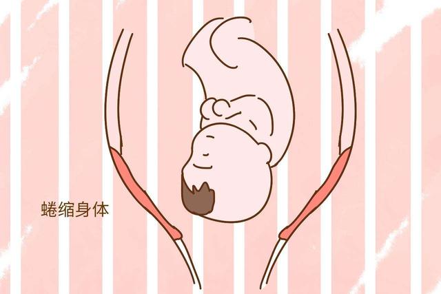 这四种类型的孕妈，分娩时开宫口会比较慢