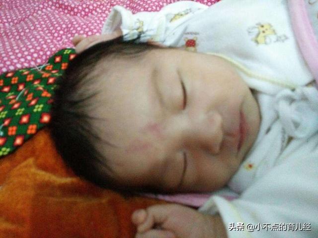 孕妈少做4件事，宝宝出生更白净，别让胎记影响宝宝颜值