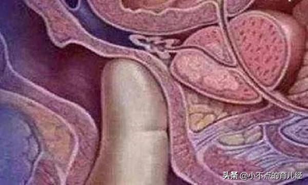 分娩之前的这项产检，如果遇到男医生会很尴尬，能避开太幸运了