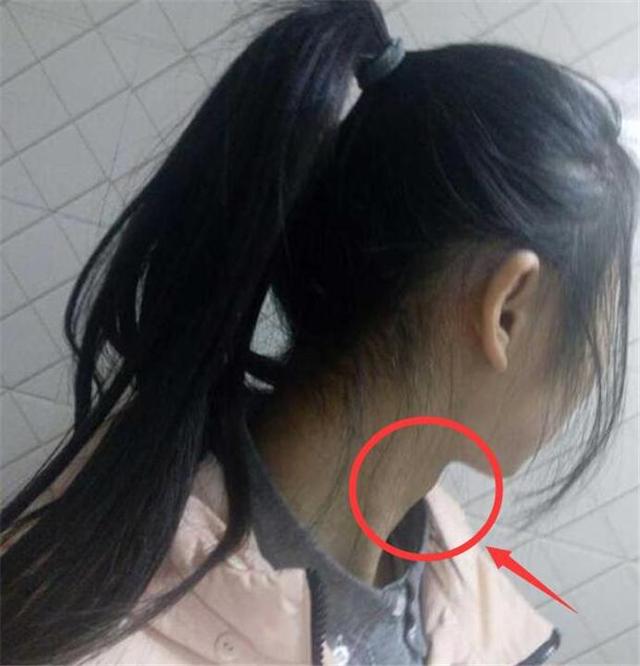 13岁女孩冒出胡子，长出喉结：这些零食，别再给孩子吃了