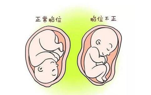 孕妇这3个“行为”，会让造成“胎位不正”，女性心里要有数
