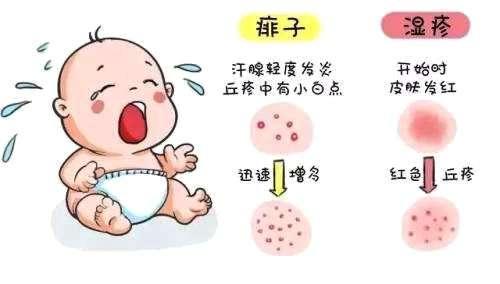 宝宝热痱和湿疹的区别，正确护理方法