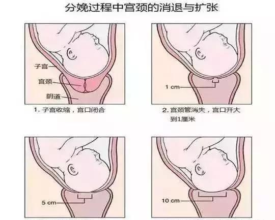 开十指”是什么？难道是要开10个手指那么大？