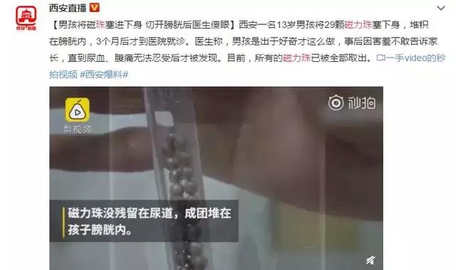 整整29颗！男童把磁力珠塞入下体！性教育1岁开始都嫌迟