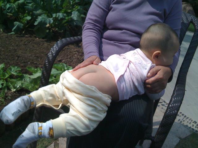 宝宝红屁屁，是体质如此吗？婴幼儿臀部护理小知识