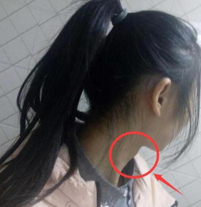 12岁女孩长胡子，有喉结，只因常吃3种食物，家长别不当回事儿