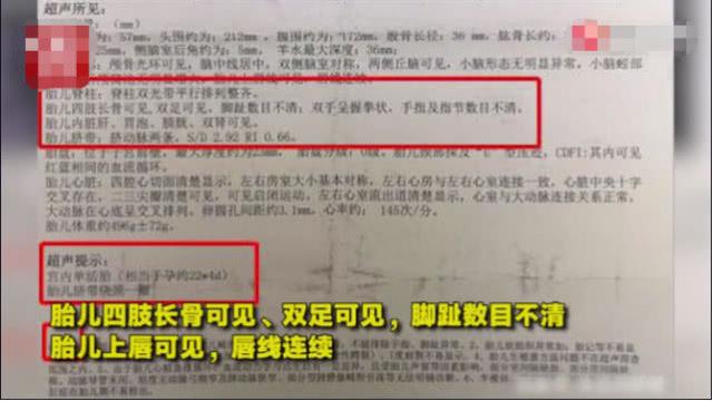 5次孕检皆安全，妈妈仍生下畸形宝宝，医生这样解释