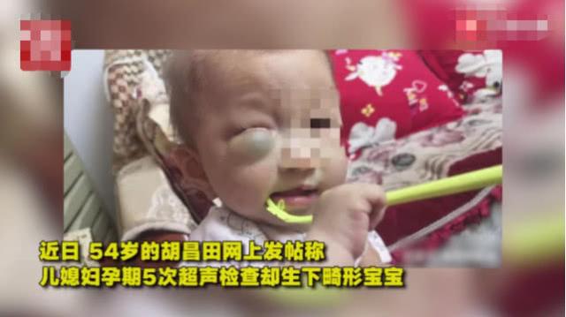 5次孕检皆安全，妈妈仍生下畸形宝宝，医生这样解释