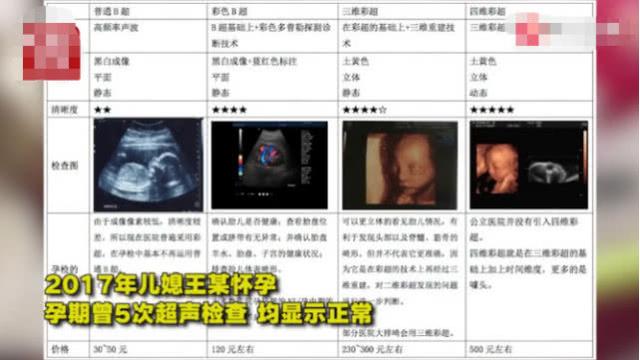 5次孕检皆安全，妈妈仍生下畸形宝宝，医生这样解释