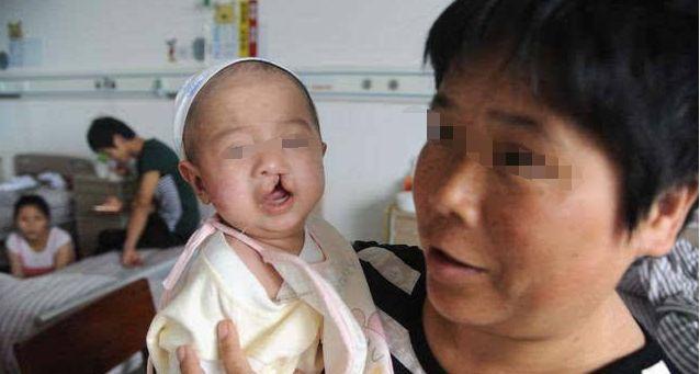 多次产检均正常，孩子出生却有畸形，医院：不是我们的责任