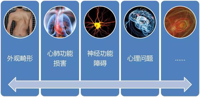 青少年脊柱侧弯不容忽视！河南省直三院免费筛查，别错过