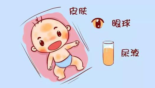 医生一般会让刚出生的宝做哪些检查？这几个是一定要做的