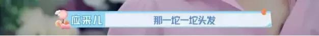 应采儿分享孕期身体变化：脚肿、脱发、肚子长毛…