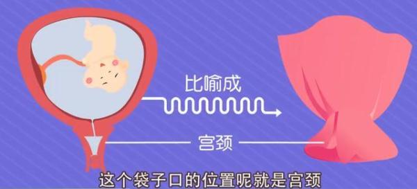 胎盘前置和胎盘低置有何不同？孕妈如何自我保健？