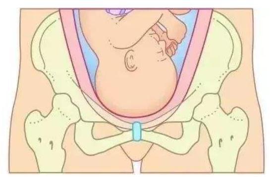 哪些孕妇需要进行剖腹产？准妈妈有必要提前了解