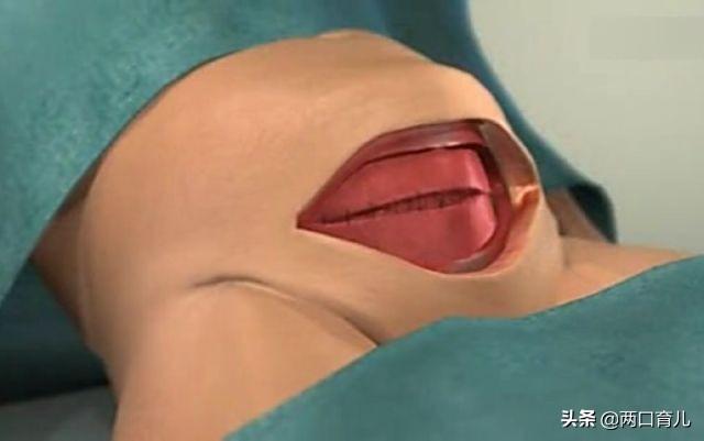 为什么剖腹产手术，大多数会选择在上午？3个好处孕妇要知道