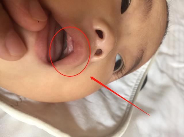 孩子一出生就有“牙齿”是好是坏？内行人讲出实话，父母要知道