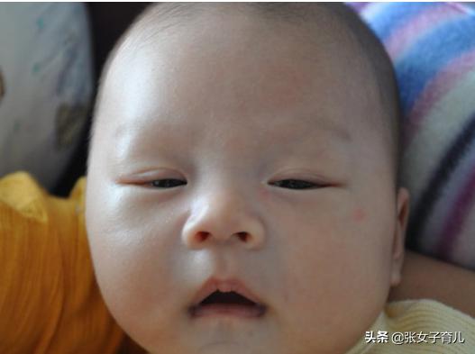 如果宝宝脸上有这3种现象，说明宝宝脾胃有问题，别不在意