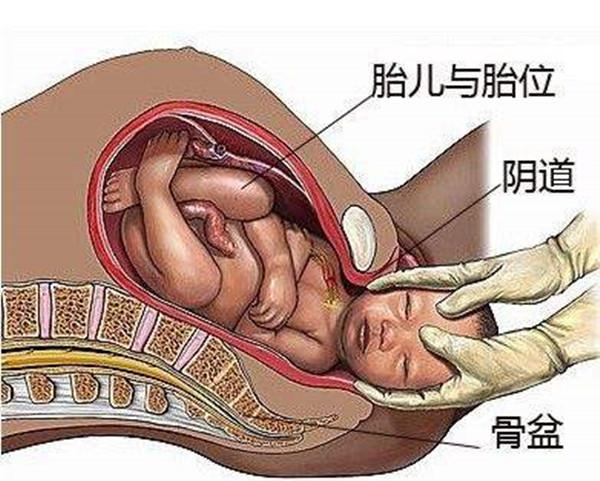 孕媽難產,折斷新生兒鎖骨娩出,影響胎兒健康嗎?