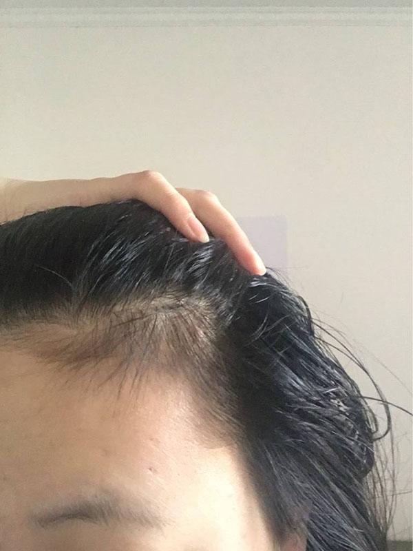 产后脱发并没有那么恐怖，妈妈们这么做一定不会错，快来试试吧