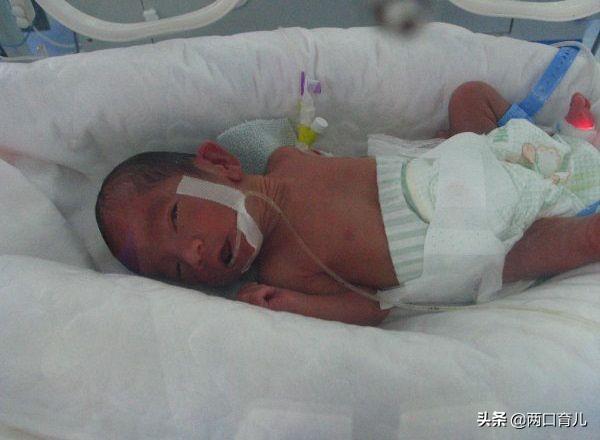 早产儿护理法则：先天性的不足，可以通过这3个护理法来弥补