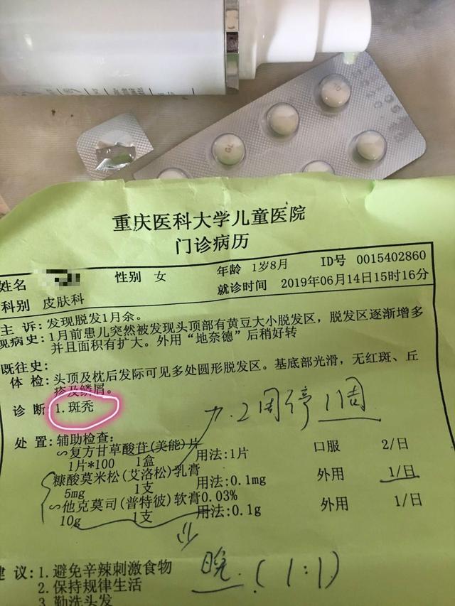 咋回事？1岁幼女早教1个多月狂掉头发被诊断为斑秃