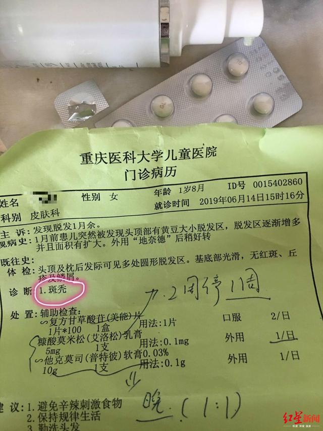 1岁多幼女早教1个多月狂掉头发家长质疑早教中心甲醛超标