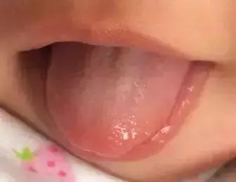 新手妈妈一定要知道的宝宝舌诊知识，图文详解了解孩子健康