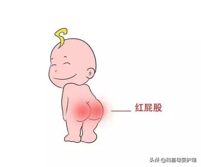 宝宝红臀、红屁股？这样做就能迅速解决