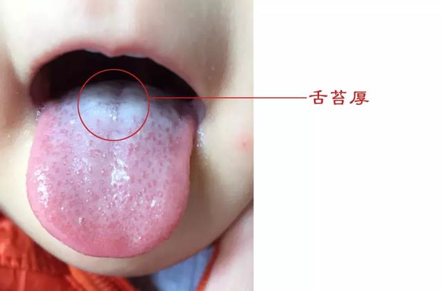 分不清寒、热、积，如何食疗护理孩子？
