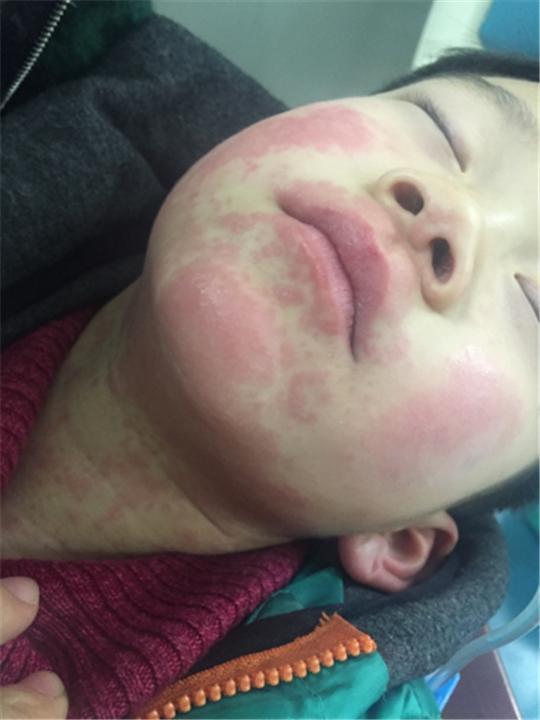 这些水果，大人吃了没事，1岁宝宝却受不了，后果比你想的更严重