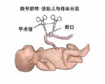 剪断脐带的时候，妈妈和宝宝会疼吗？脐带护理这3点要做到