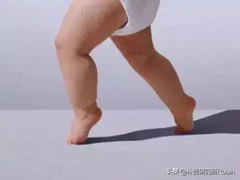 一岁多宝宝走路跛行，一定要多个心眼，纠正晚了倾尽一生难弥补