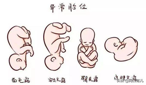 孕期胎位正不正，就看宝宝的手脚放在哪里，在家也能知道