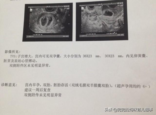 孕期50天的孕囊数据，能判断出胎宝宝性别？妇产科医生这么回答