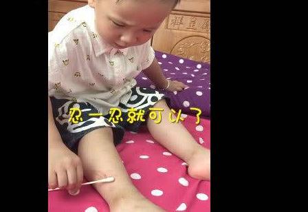 3岁萌娃擦伤流血自己擦药，还安慰妈妈别担心：我自己来