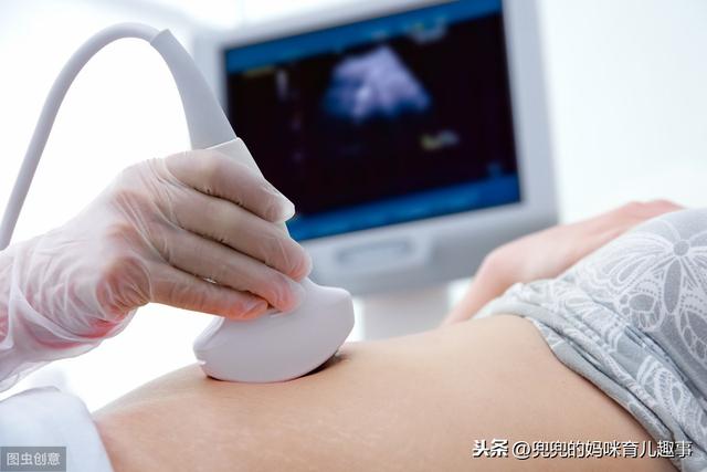 孕期50天的孕囊数据，能判断出胎宝宝性别？妇产科医生这么回答